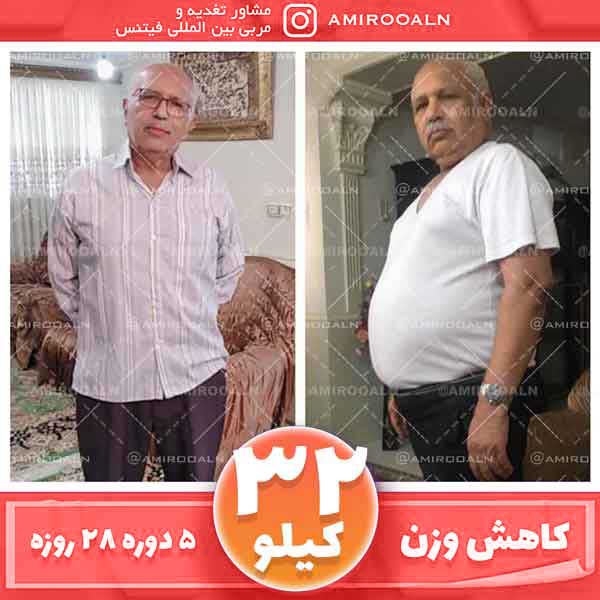 رژیم فست دکتر علائی